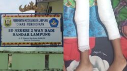 Kaki Dipasang Pen, Siswa Kelas 1 SDN 2 Way Dadi Baru Diduga Jadi Korban Bullying