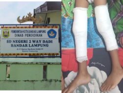Kaki Dipasang Pen, Siswa Kelas 1 SDN 2 Way Dadi Baru Diduga Jadi Korban Bullying